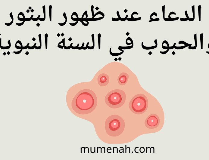 الدعاء عند ظهور البثور والحبوب في السنة النبوية وعلاجها