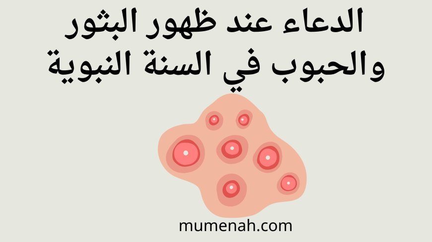 الدعاء عند ظهور البثور والحبوب في السنة النبوية وعلاجها